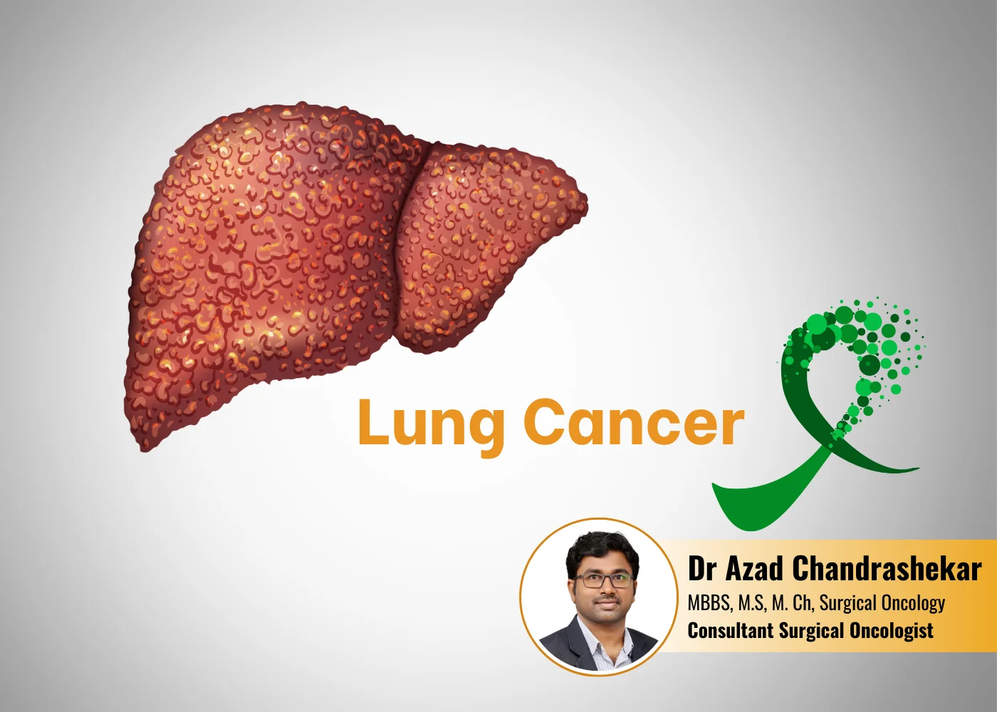 Liver Cancer treatment in Hyderabad